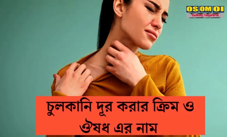 সারা গায়ে চুলকানি ঔষধ